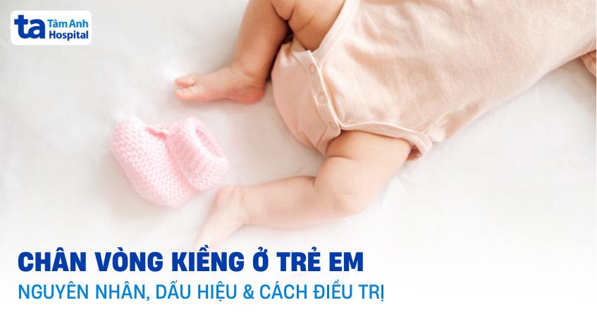 Chân cong bất thường ở trẻ