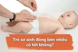 Có nên đóng bỉm 24/24 cho trẻ sơ sinh?
