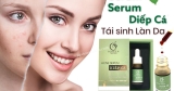 [Review] Serum diếp cá IGREEN trị mụn có tốt? Có phải KEM TRỘN?